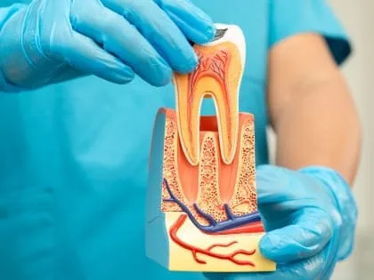 Tratamento do canal radicular (Endodontia)